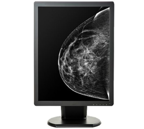Double Black Imaging 5MP Monochrome Display For Mammography And Tomo Double Black Imaging 5MP Monochrome Display For Mammography And Tomo